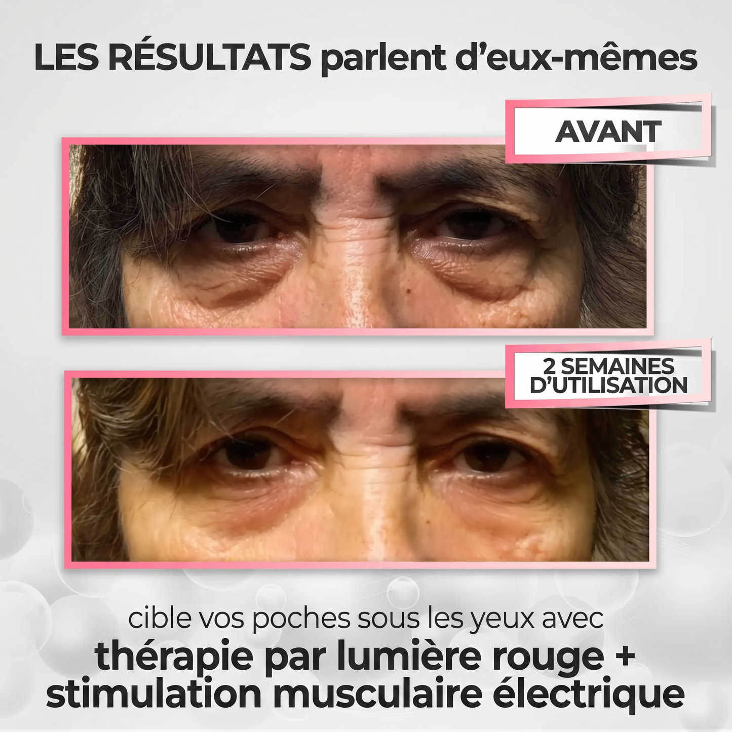 EyeLift Pro™ — Luminothérapie Rouge + Microcourants pour Effacer les Poches Sous les Yeux