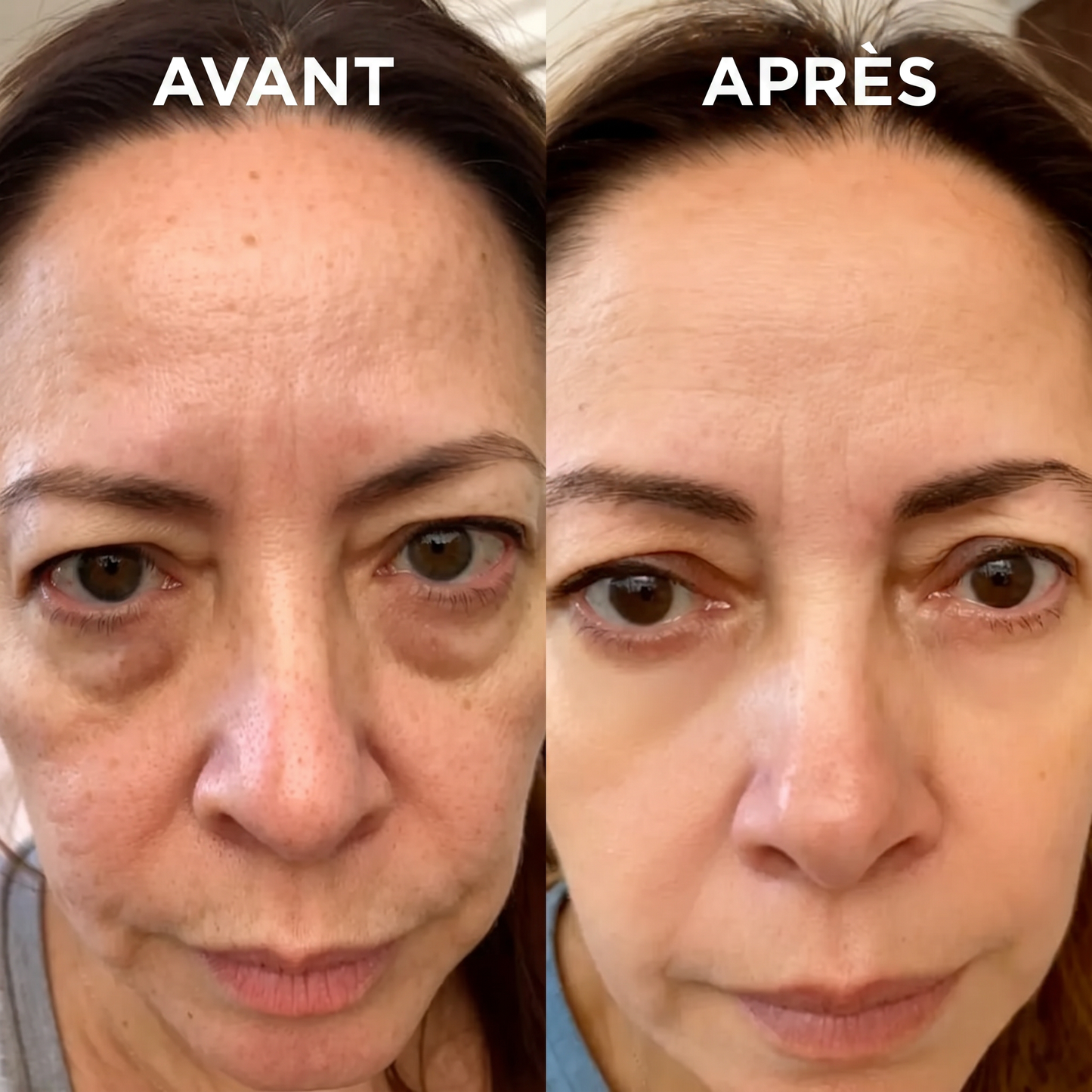 EyeLift Pro™ — Luminothérapie Rouge + Microcourants pour Effacer les Poches Sous les Yeux
