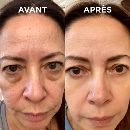EyeLift Pro™ — Luminothérapie Rouge + Microcourants pour Effacer les Poches Sous les Yeux