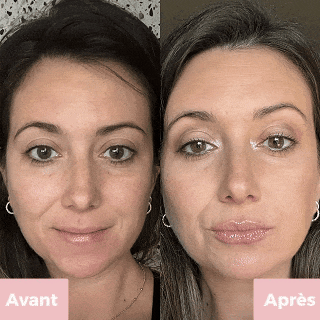 Kiss Me Kit™ — Kit Repulpant Lèvres