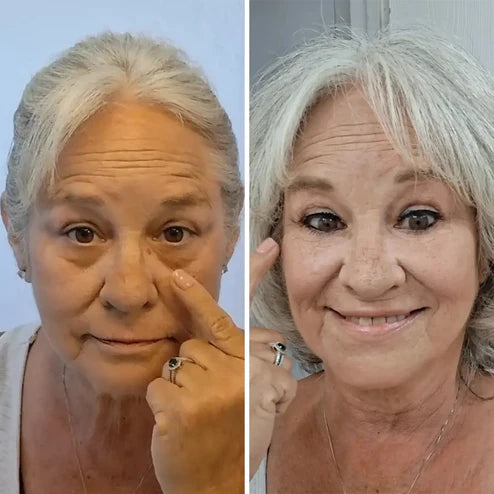 Éclatbalm - Soin contour des yeux tout-en-un