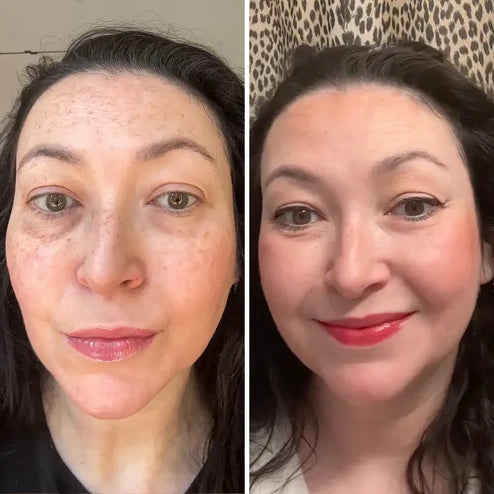 Éclatbalm - Soin contour des yeux tout-en-un