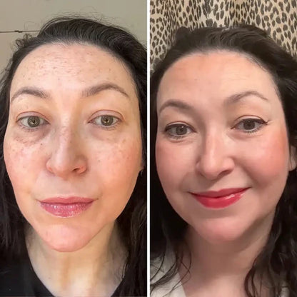 Éclatbalm - Soin contour des yeux tout-en-un