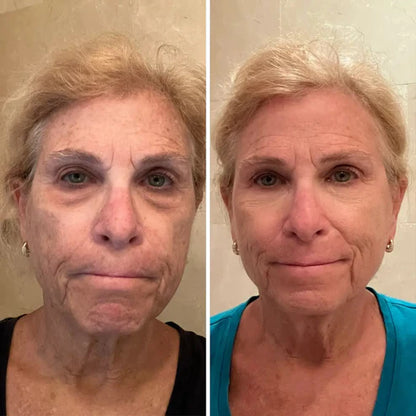 Éclatbalm - Soin contour des yeux tout-en-un