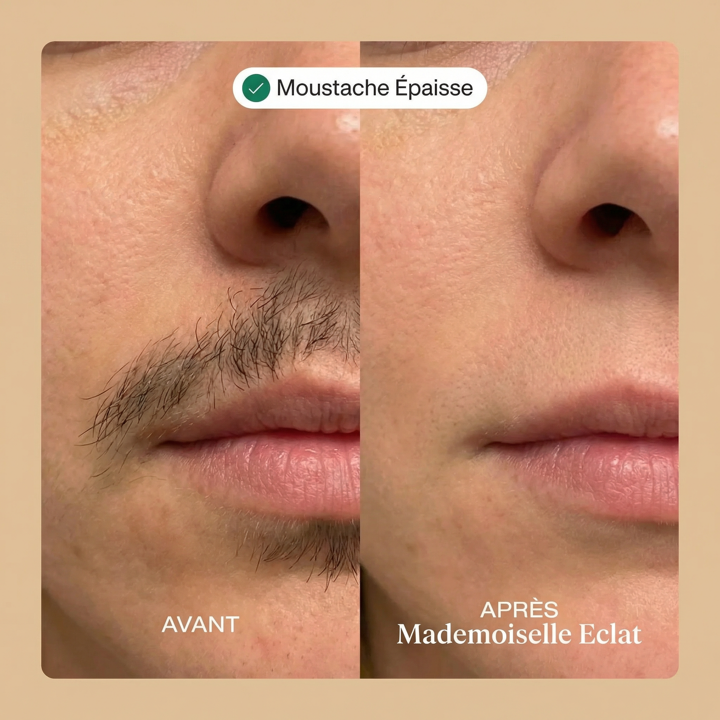 Crème épilatoire visage