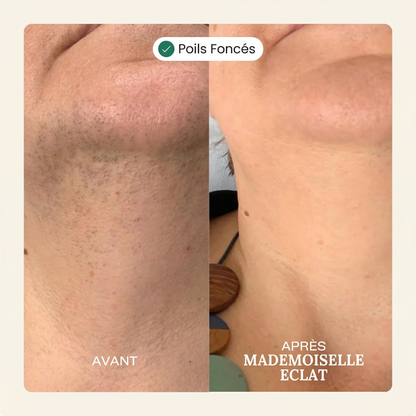 Crème épilatoire visage