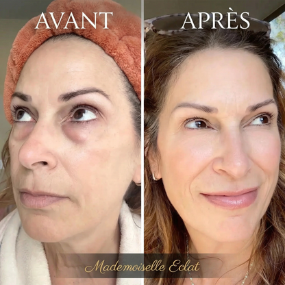 Éclatbalm - Soin contour des yeux tout-en-un