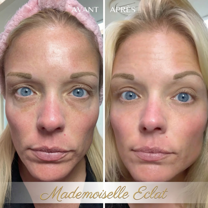 Éclatbalm - Soin contour des yeux tout-en-un
