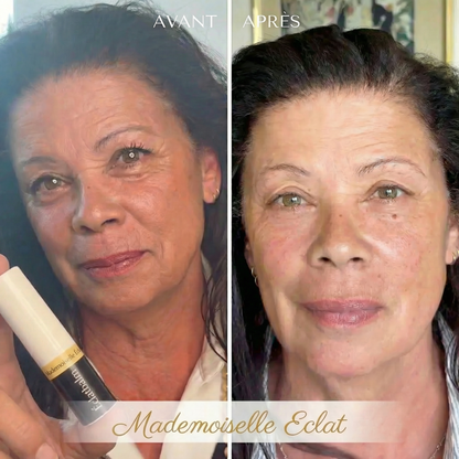 Éclatbalm - Soin contour des yeux tout-en-un